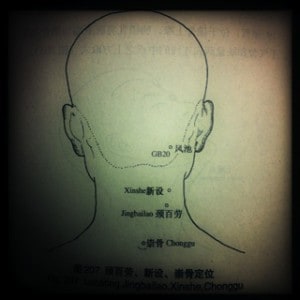 acupuncture point to treat headache and common cold